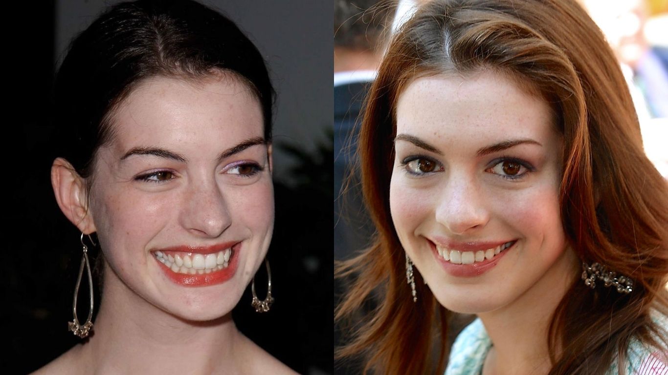 Growth Between First and Second Movie